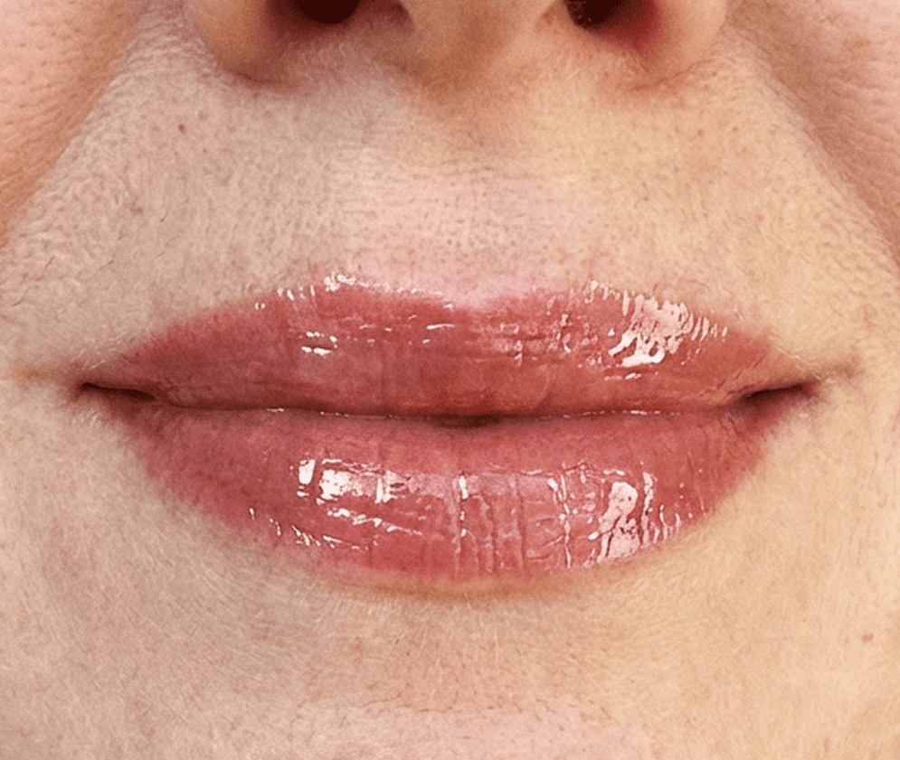 Mylipz